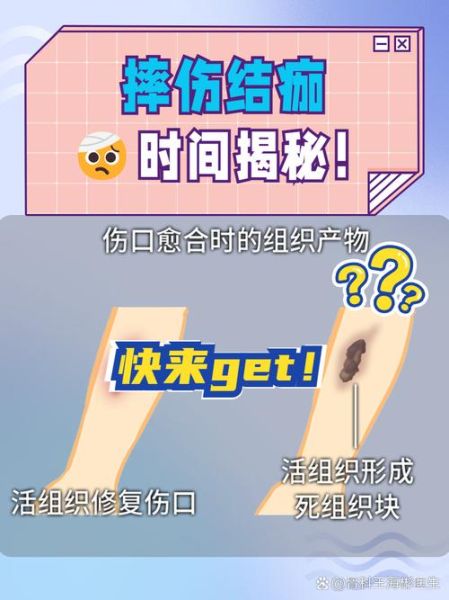 摔伤后怎么处理_摔伤后多久能好