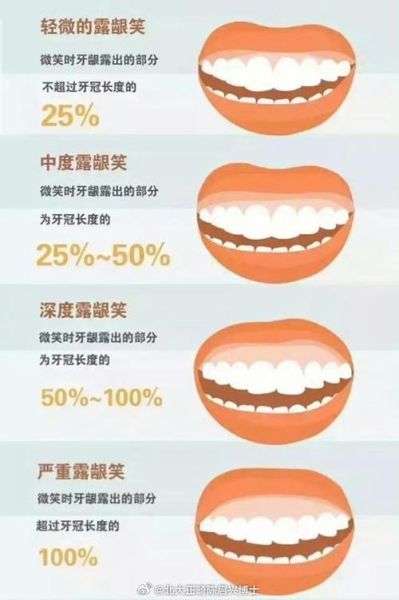 口笑是什么意思_口笑的由来与用法