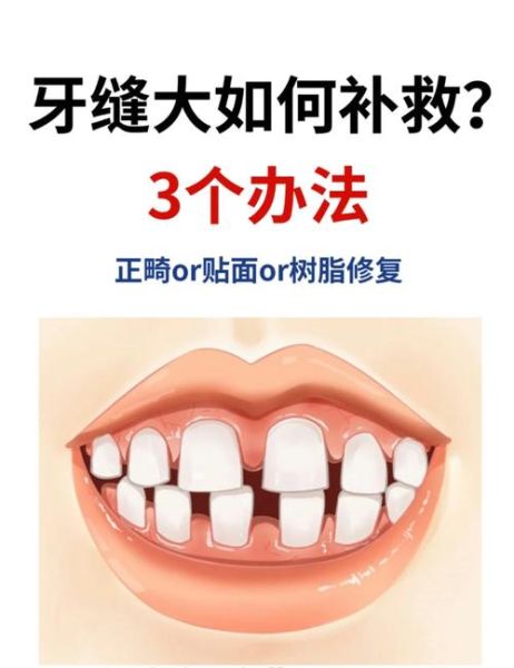 牙齿疼怎么办_牙缝大怎么补