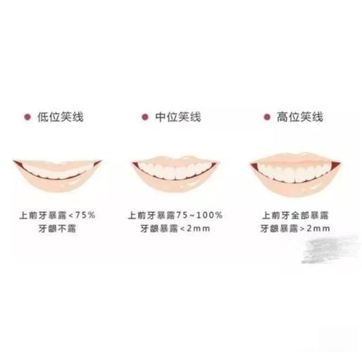 微笑笑眯眯的区别是什么_如何正确使用微笑笑眯眯