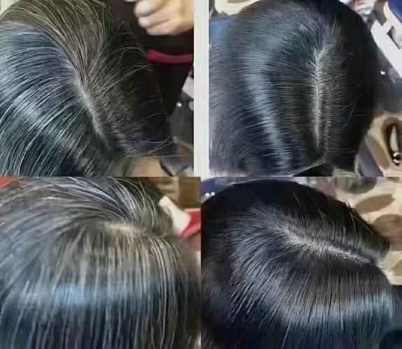 女人白发吃什么好_白发能变黑吗