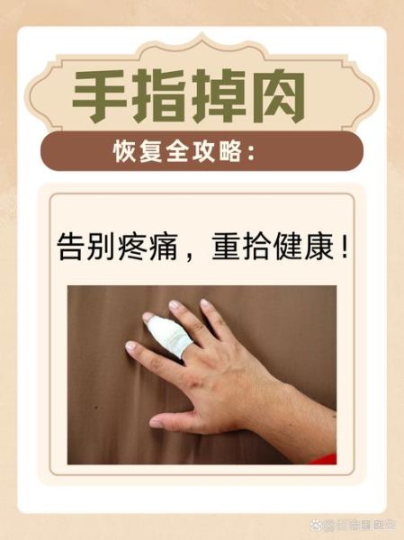 手坏了怎么快速恢复_手坏了需要多久能好