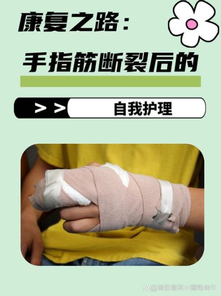手坏了怎么快速恢复_手坏了需要多久能好