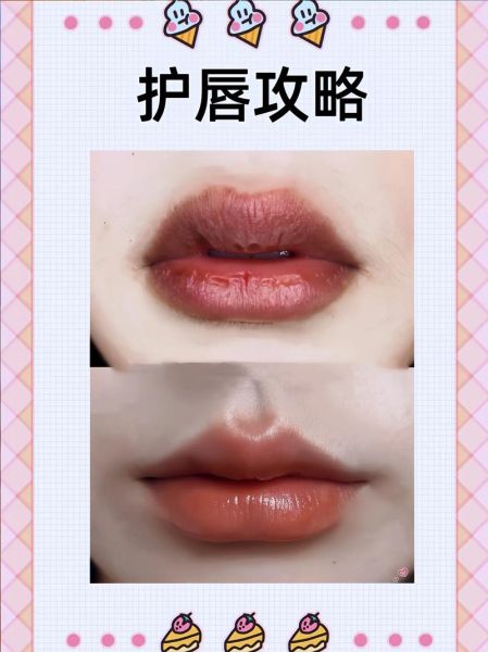 嘴唇干裂怎么护理_唇部护理的正确步骤