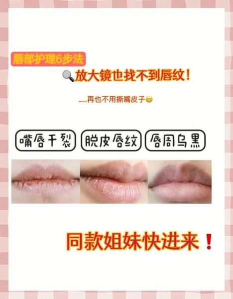 嘴唇干裂怎么护理_唇部护理的正确步骤