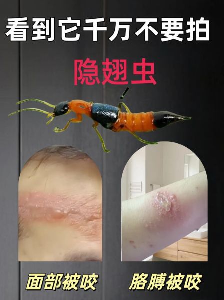 梦到毒虫子是什么意思_如何化解噩梦
