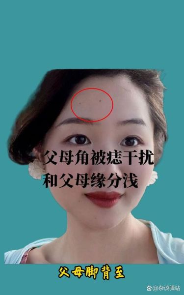 额头凹陷会影响财运吗_如何化解