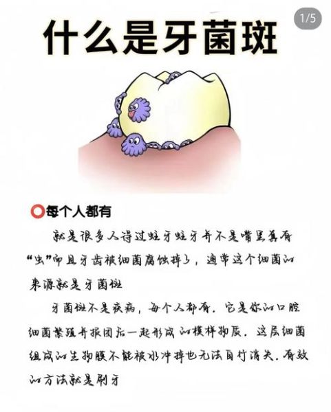梦到蛀牙是什么意思_梦到蛀牙掉牙怎么办