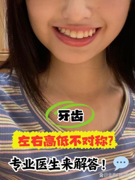 牙齿不齐影响财运吗_牙难看真的破财吗