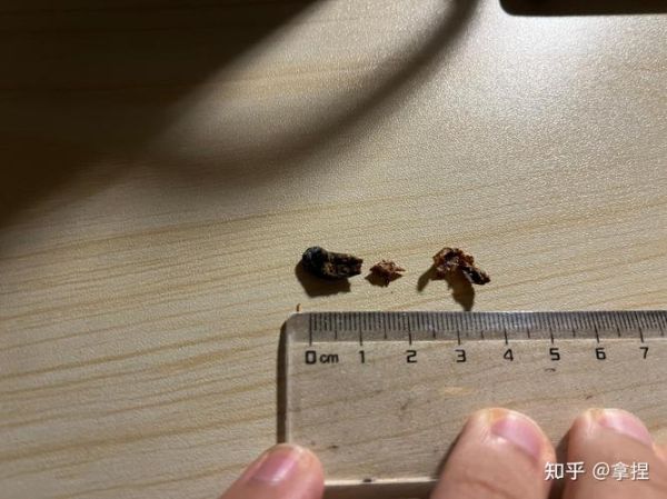 梦到给别人挖耳屎_是什么意思