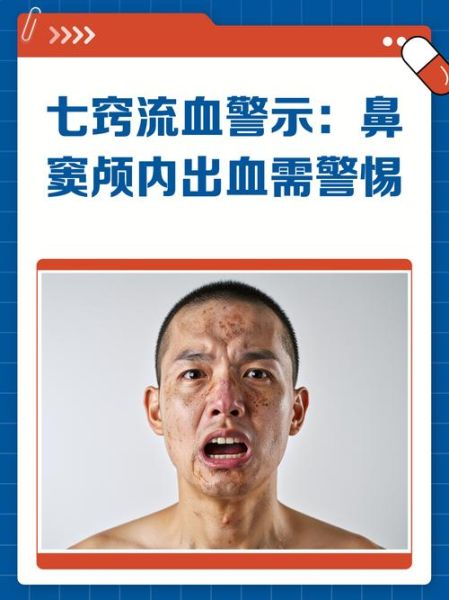 梦到七窍流血是什么意思_梦到自己七窍流血预示什么