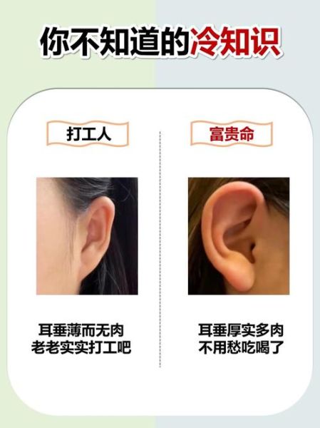 耳垂肥厚运势_耳垂肥厚的人财运好吗