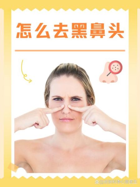 鼻子有黑头影响财运吗_去黑头会转运吗