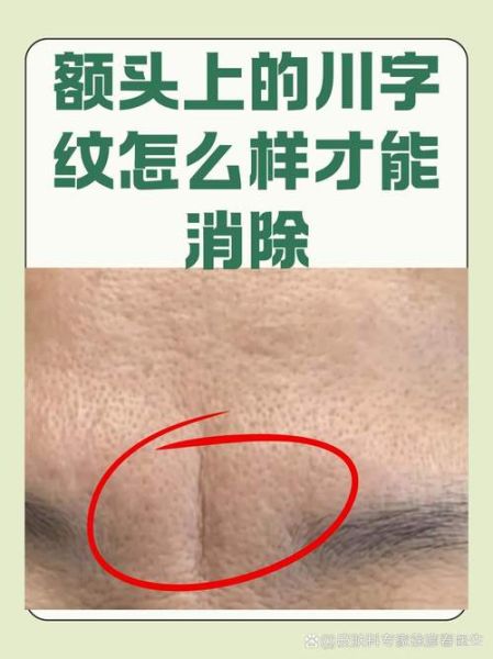 川字纹运势_川字纹运势怎么看
