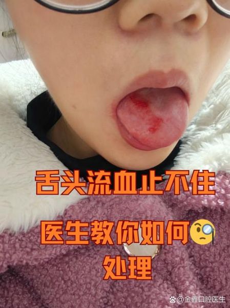梦到舌头受伤是什么意思_舌头受伤梦境解析