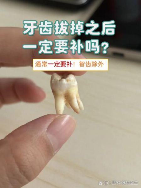 拔牙会影响财运吗_拔牙后运气变差是真的吗