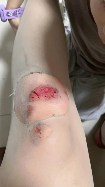 梦到骑车子是什么意思_骑车摔倒预示什么