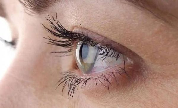 梦见眼睛模糊看不清_周公解梦含义