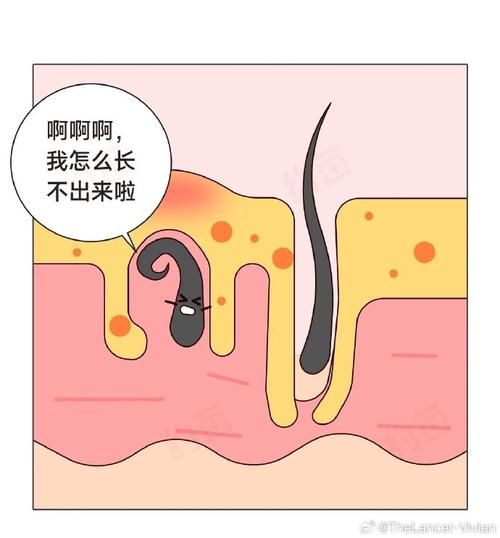男人乳头长毛有财运吗_男人乳头长毛代表什么