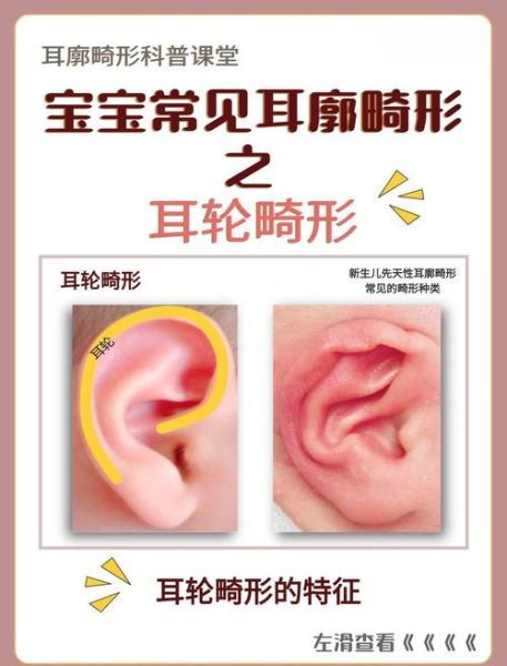 耳轮厚大的人财运真的好吗_如何从耳轮看财富潜力