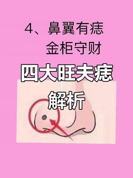 痣的位置看财运_哪些痣代表富贵命