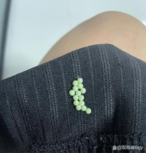 梦到虫卵是什么意思_梦见虫卵预示什么