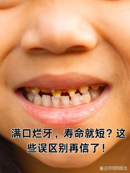 梦到牙烂了是什么意思_梦到牙齿坏了代表什么