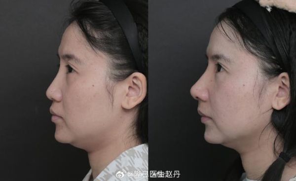 鼻尖圆钝面相财运好吗_鼻尖圆钝的人如何聚财