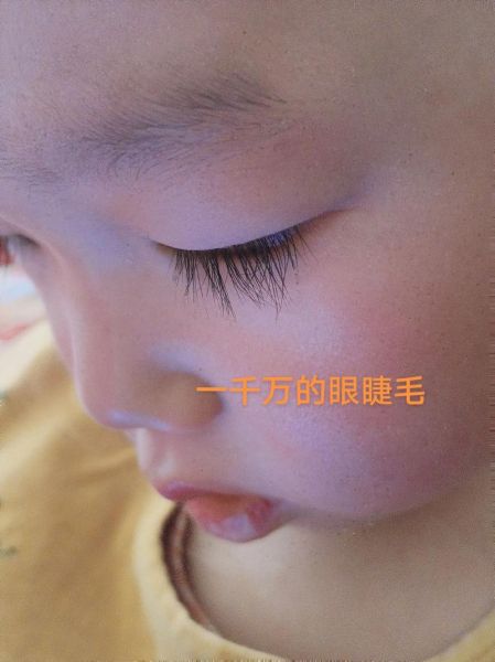 梦到睫毛掉了是什么意思_梦到睫毛掉了怎么办