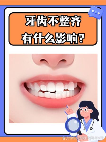 牙不齐会影响财运吗_牙齿不齐风水说法