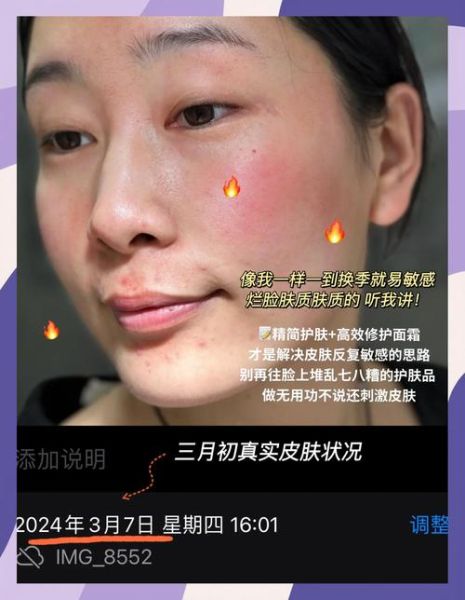 梦到脸烂了是什么意思_梦见脸烂了怎么办