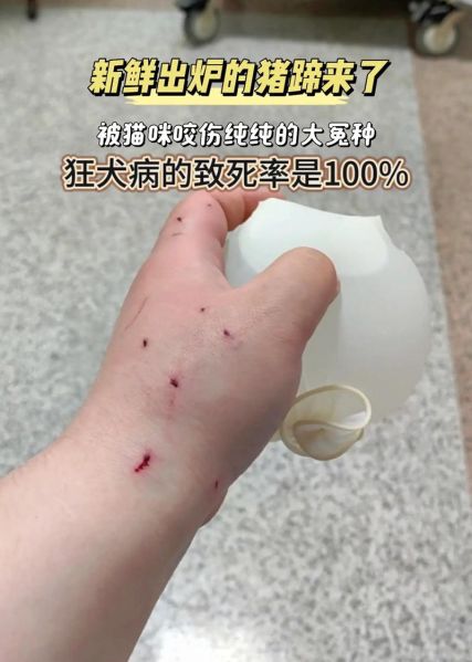 梦到被猫攻击是什么意思_被猫咬了怎么办
