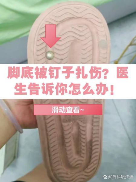 梦到钉子扎脚是什么意思_梦见钉子扎脚预示什么