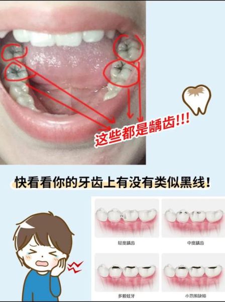 梦到牙齿变黑是什么意思_如何化解