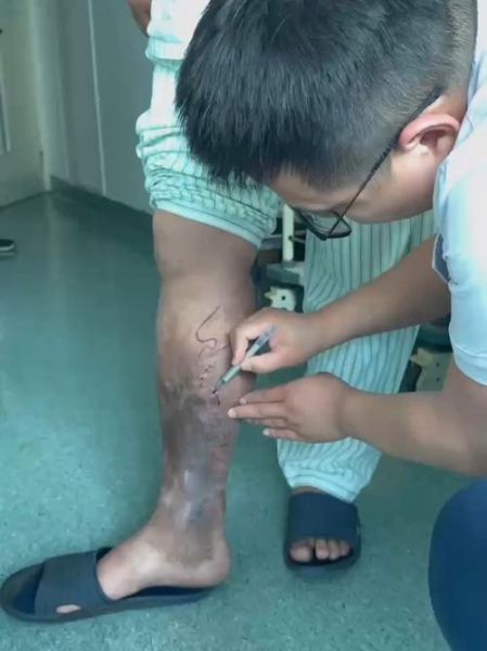 梦到腿发黑_梦见腿变黑代表什么