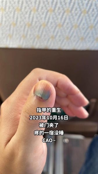 梦到手指甲断了_梦到手指甲脱落是什么意思