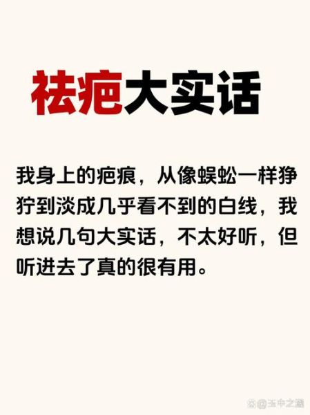 额头有疤会影响财运吗_额头疤痕怎么改运