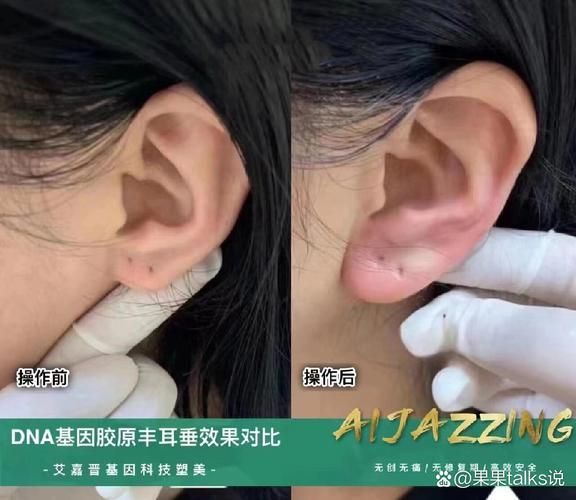 耳朵形状看财运_耳垂大真的招财吗