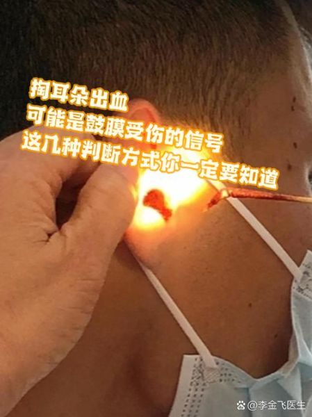 梦到耳朵流血_是什么预兆
