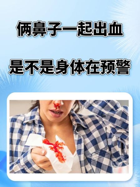 梦到别人鼻子出血_是什么预兆