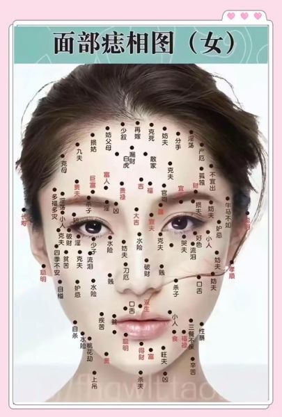面部痣相图解_哪些痣能带来财运