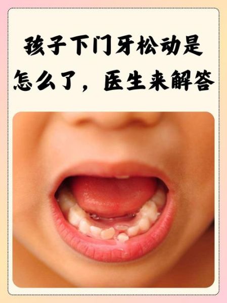 梦到门牙松动是什么意思_如何化解不安