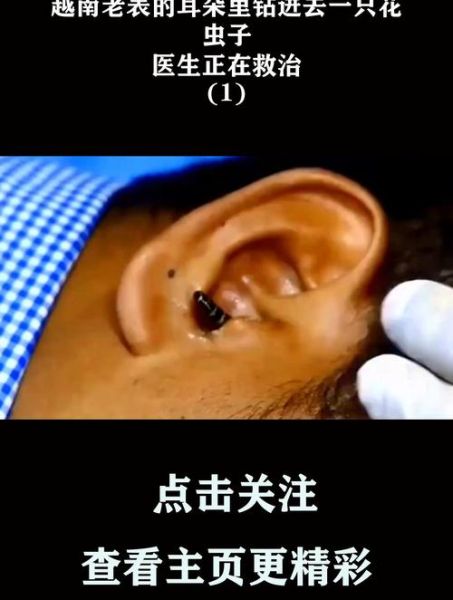 梦到耳朵里掏出虫子_意味着什么