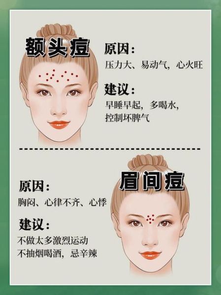 梦到脸上长痘痘_梦见脸上长痘痘是什么意思