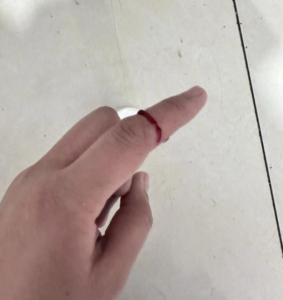 梦到割手了_梦见手被割破预示什么