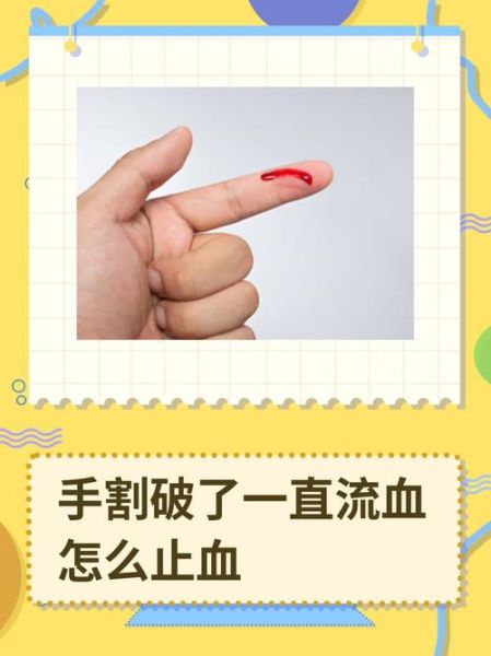 梦到手出血是什么意思_梦见手流血预示什么