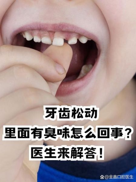 梦到牙齿松动_牙齿松动预示什么