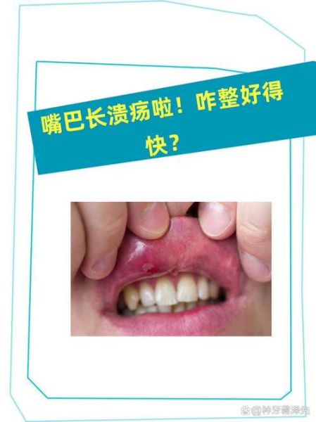梦到嘴烂了_梦见嘴巴溃烂是什么意思