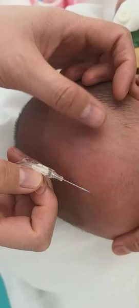 梦到针头是什么意思_梦到针头扎自己预示什么