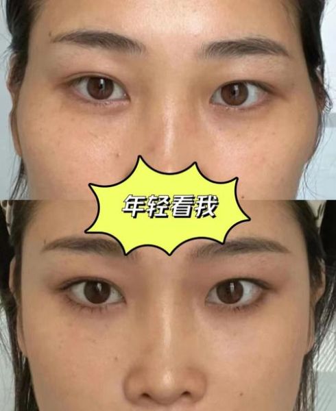 太阳穴凹陷影响财运吗_面相学真相